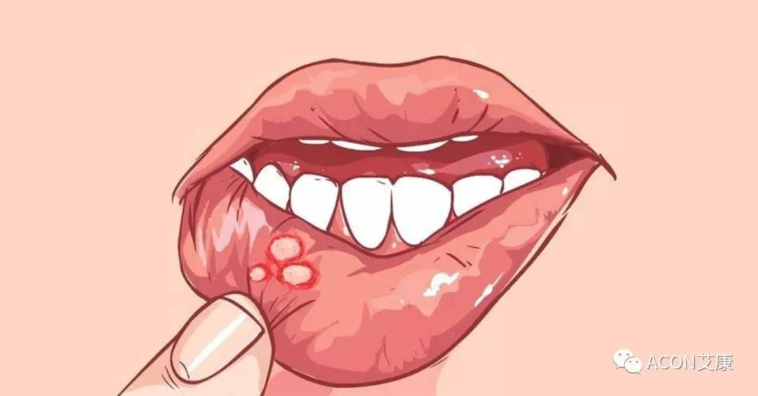 哪些小病容易讓人忽視，最后造成越拖越嚴重呢？