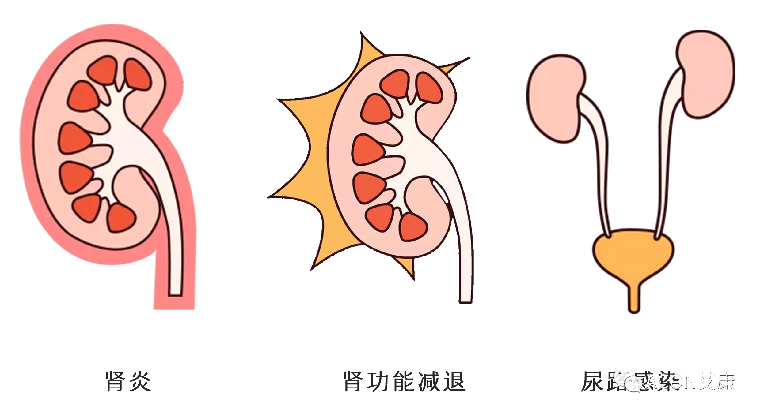 排尿黃、異味大，可能是身體在報警！
