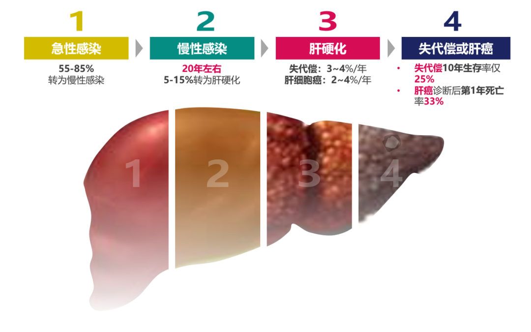 悄悄變成肝硬化、肝癌，很多人感染了卻不知道