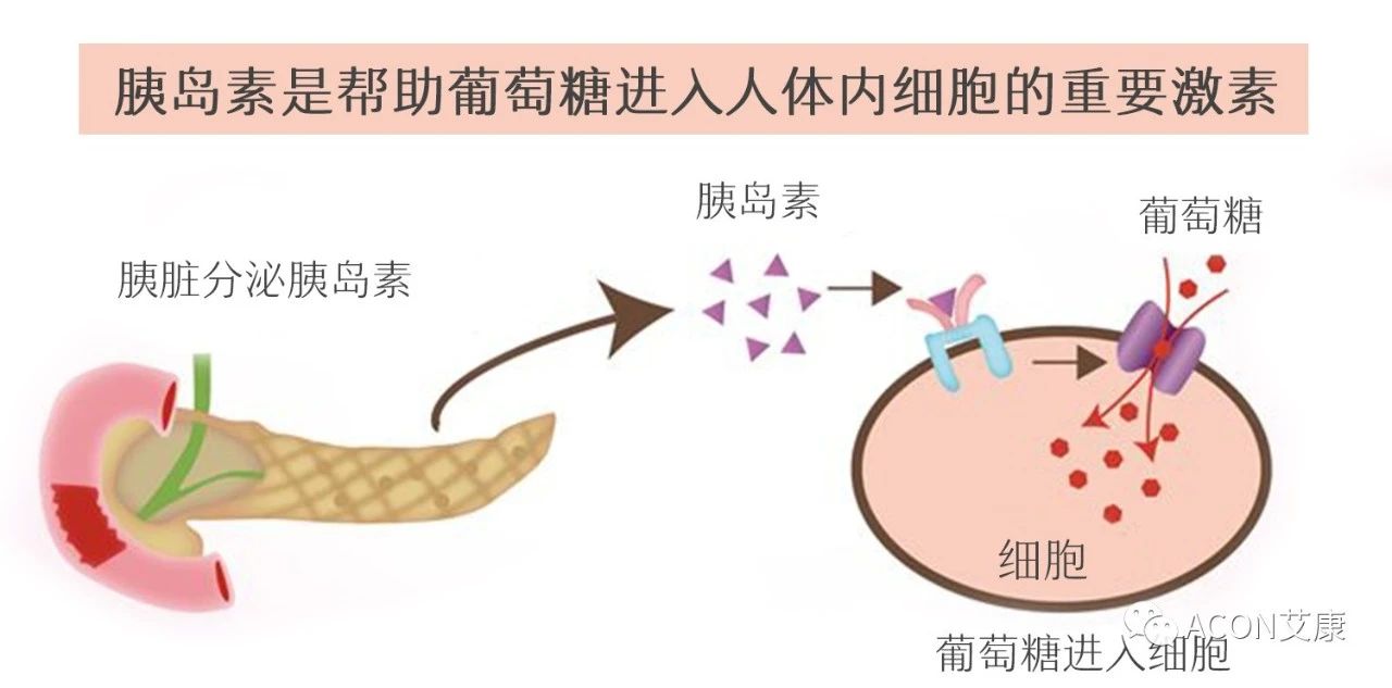 爆上熱搜，因爆發(fā)型糖尿病進(jìn)入ICU，有哪些教訓(xùn)值得我們汲取