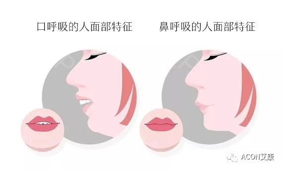 過敏性鼻炎會讓孩子變傻？！家長該如何應對